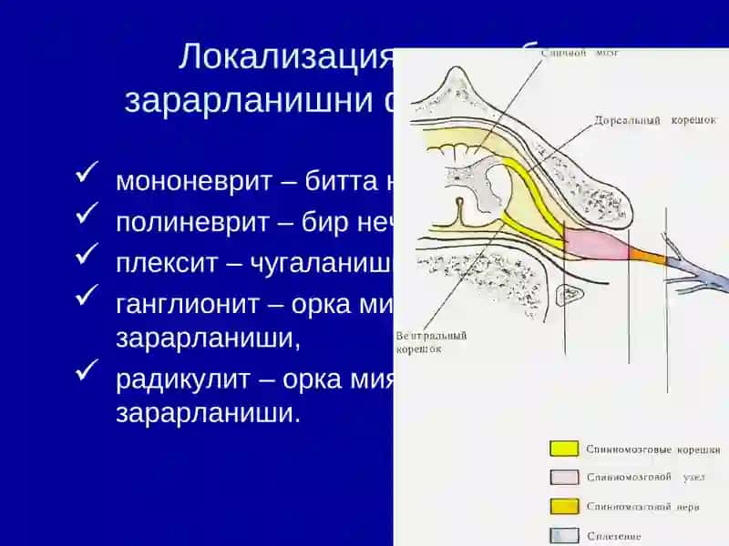 НЕРВ СИСТЕМАСИНИНГ ПЕРИФЕРИК КАСАЛЛИКЛАРИ 4