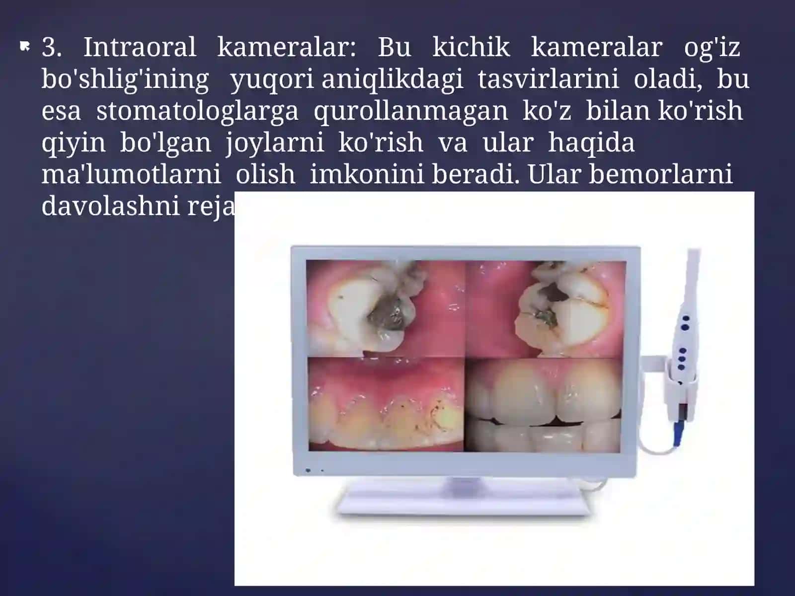 Stomatologik bemorlar kariesni tekshiradi 4
