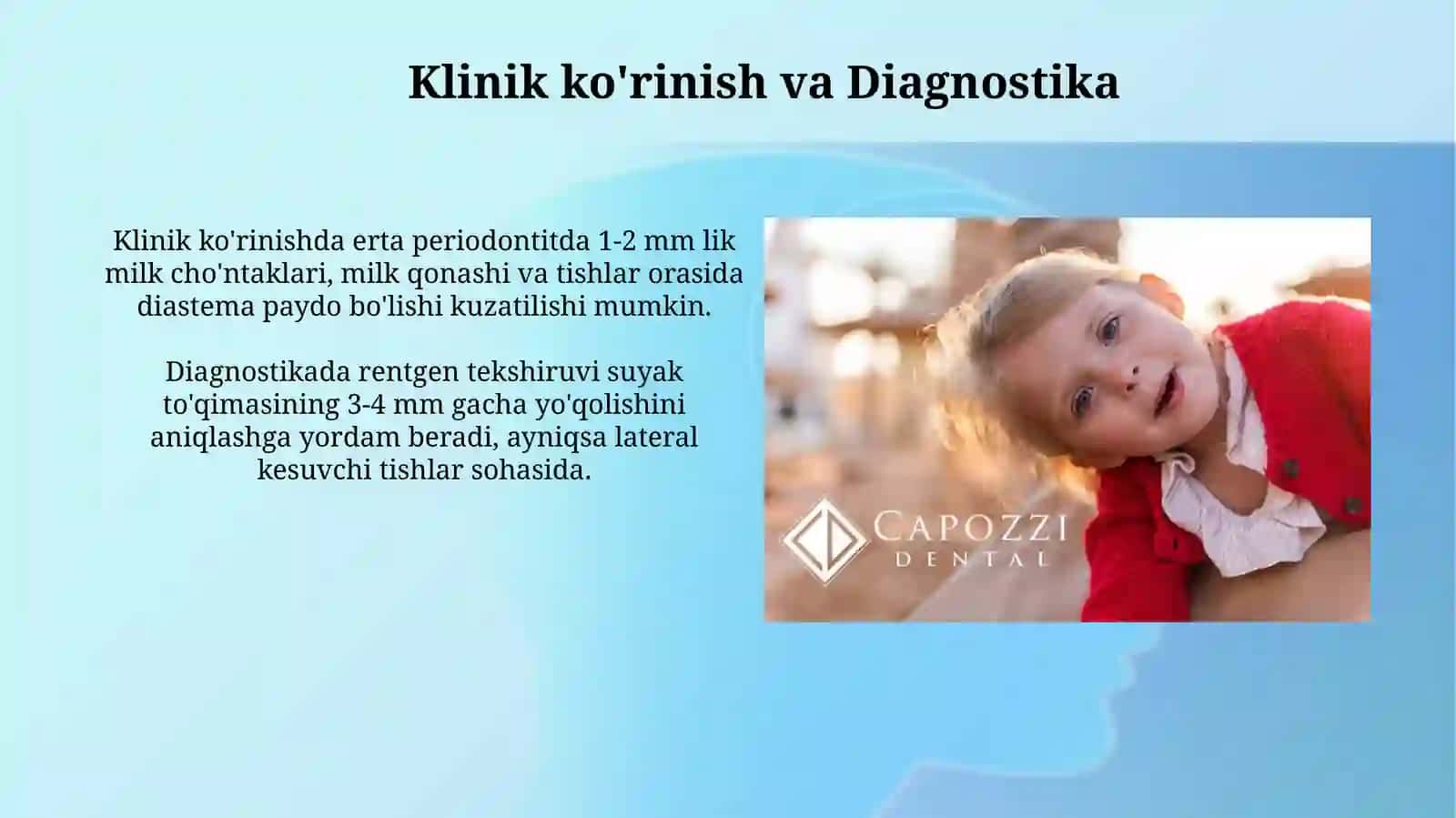 Bolalarda surunkali periodontit 4