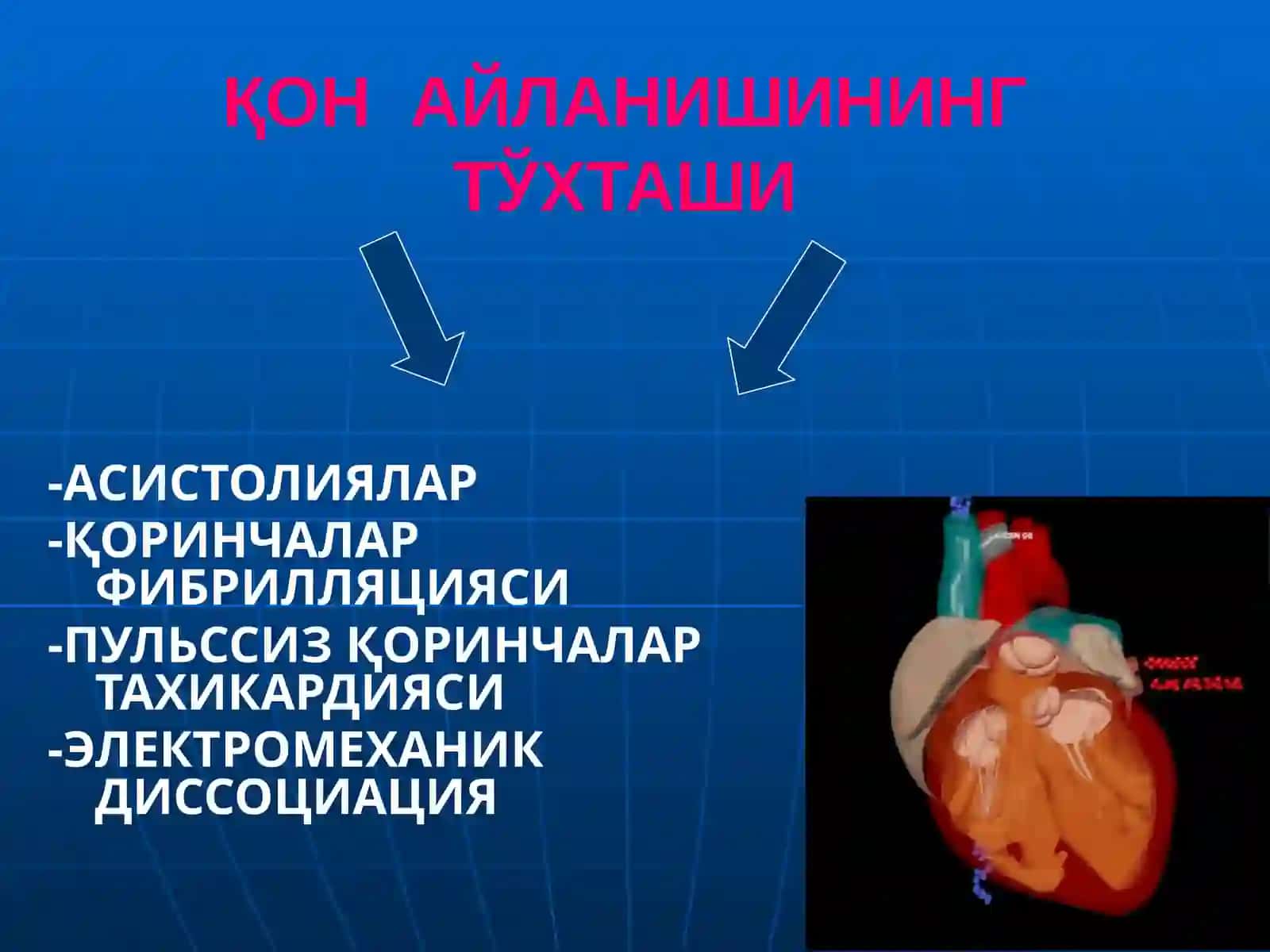 ЮРАК- ЎПКАРЕАНИМАЦИЯСИНИ ЎТКАЗИШ 4