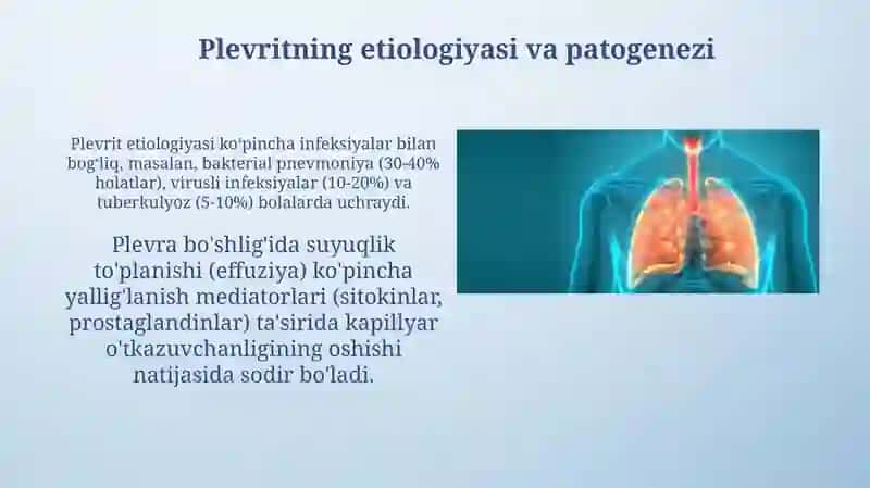 Bolalarda nafas tizimi kasalliklarini semiotikasi: Plevrit 4