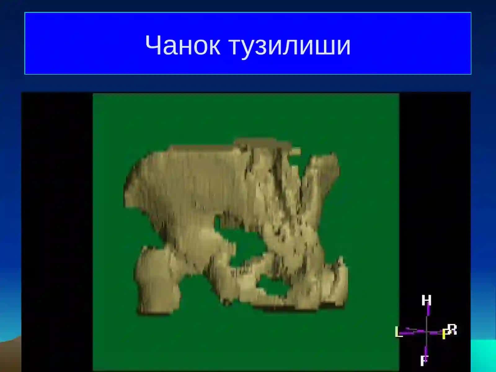 Чанок суяклари ва умуртка погонаси синишлари 4