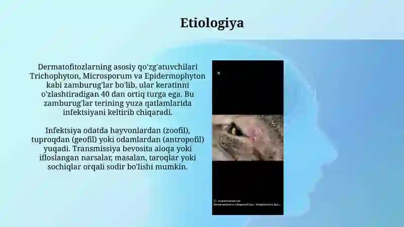 Dermatomikoz qozg’atuvchilari 4