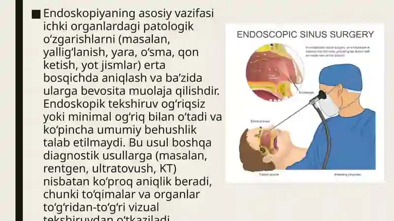 Tibbiyotda endoskopik usullarning qoʻllanishi 4