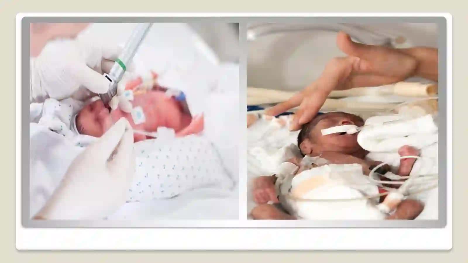 Perinatal O'lim: Ta'rif va Epidemiologiya 4