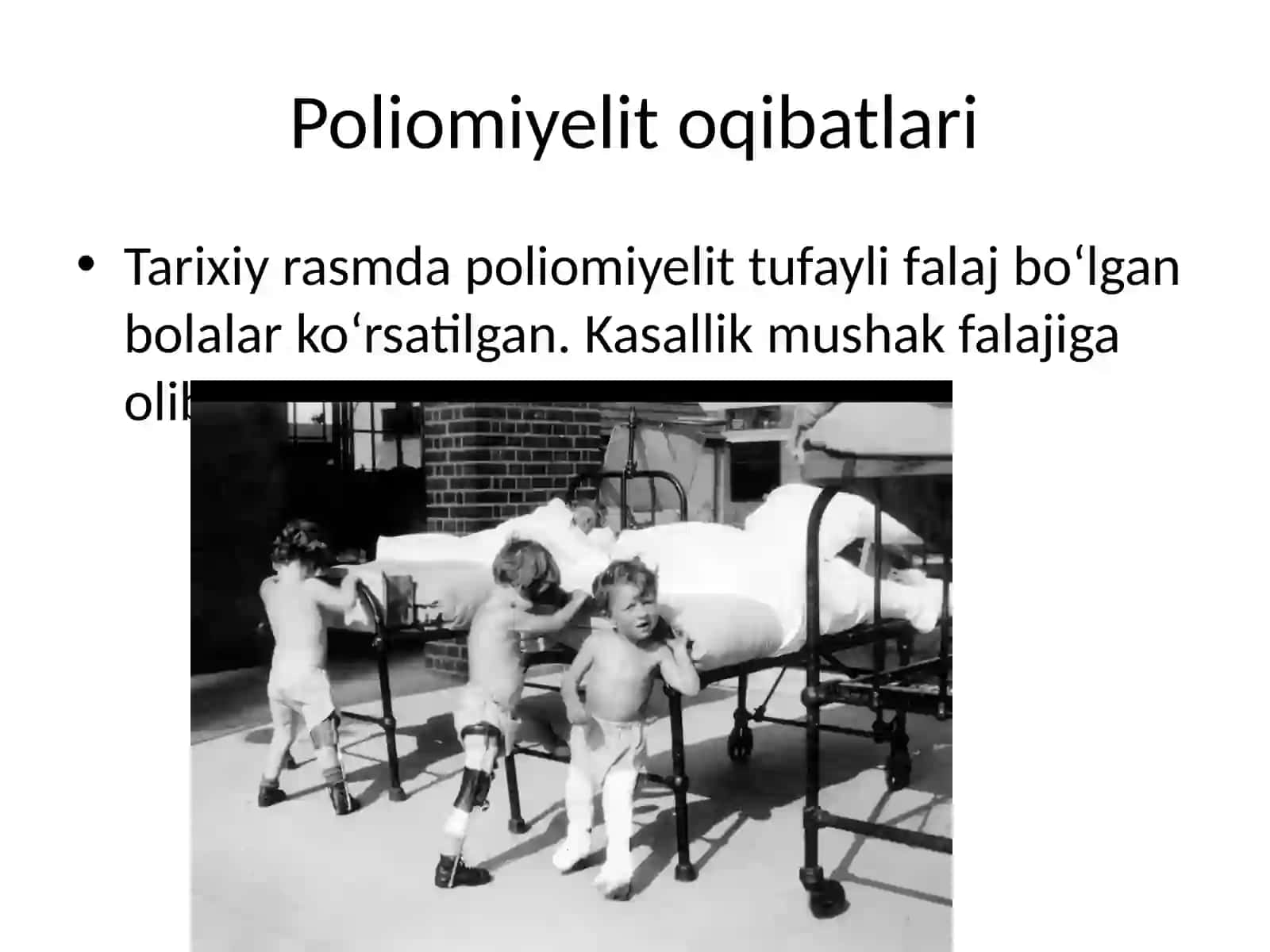 Poliomiyelit kasalligi 4