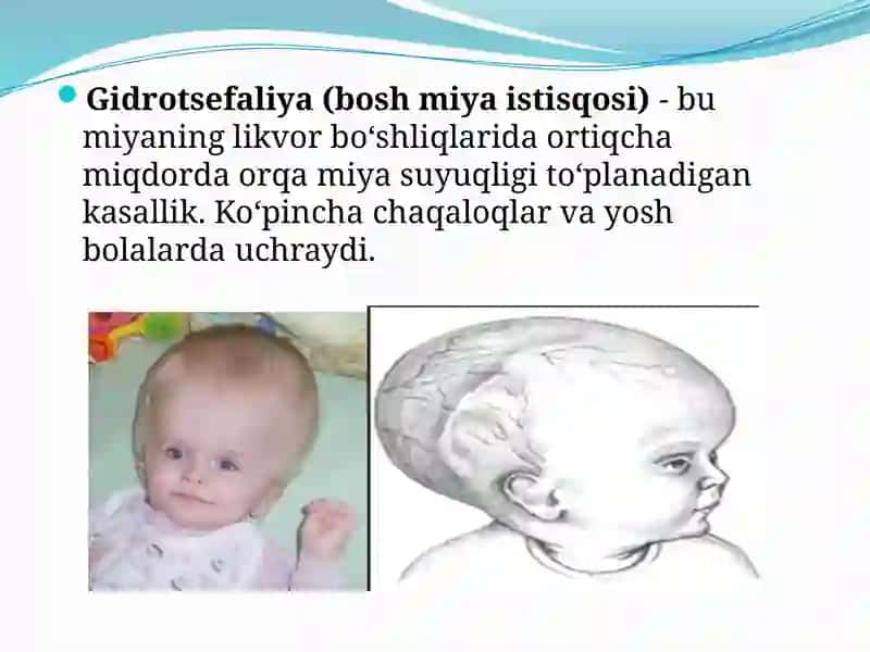 Radiologiya fanidan mustaqilishi 4