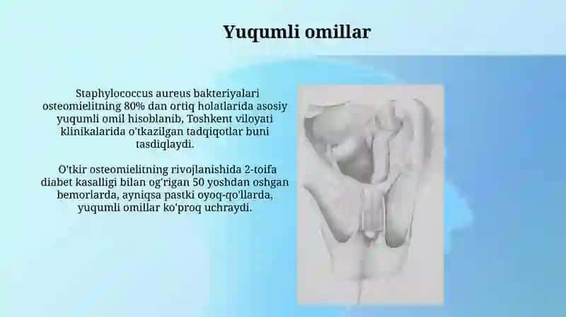 Osteomielit kasalligining patologikanatomiyasi 4