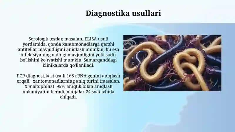Xivchinlilar odam parazitlari 4