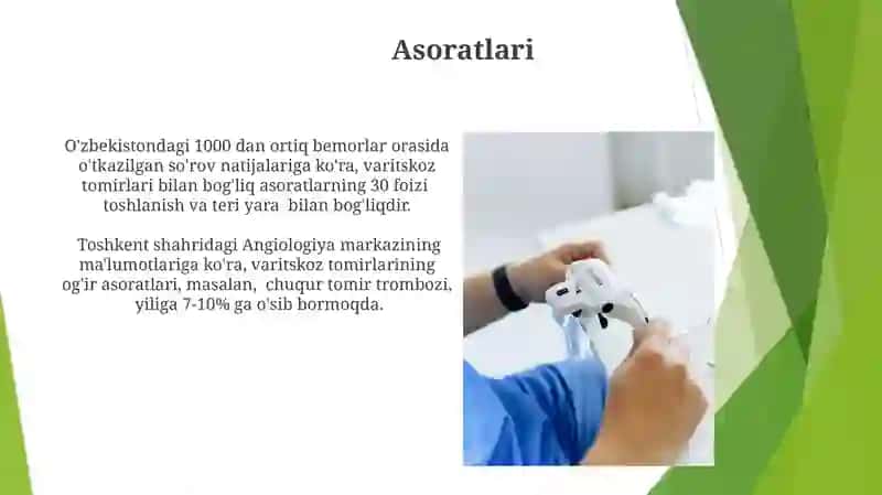 Varikoʻz kassalligi 4