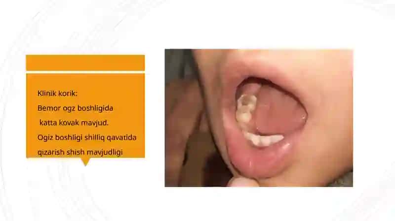 STOMATOLOGIK KARTA 4