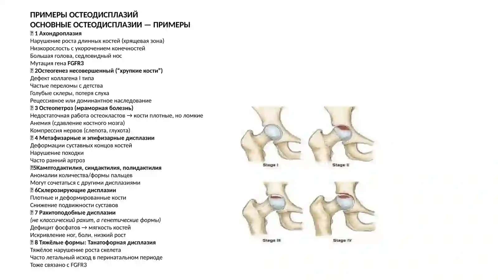 Нарушения развития костей. Переломы.Остеонекроз 4