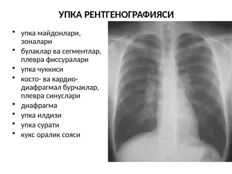 Упка Касалликарининг Нур Ташхиси 4