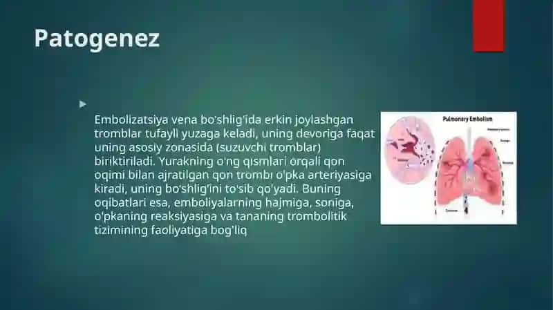 O’pka arteriyasi tromboemboliyasi 4