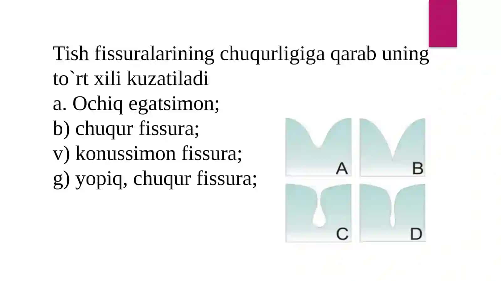 Fissur germetiklar. Qo'llash texnikasi 4
