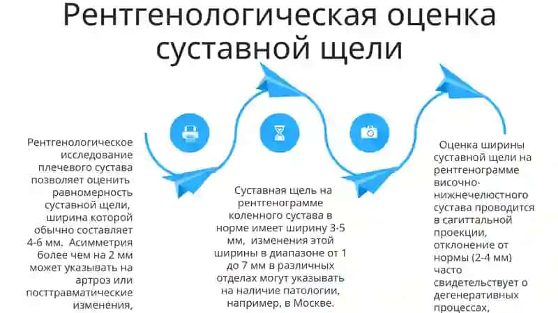 Рентгеноанатомия суставов 4