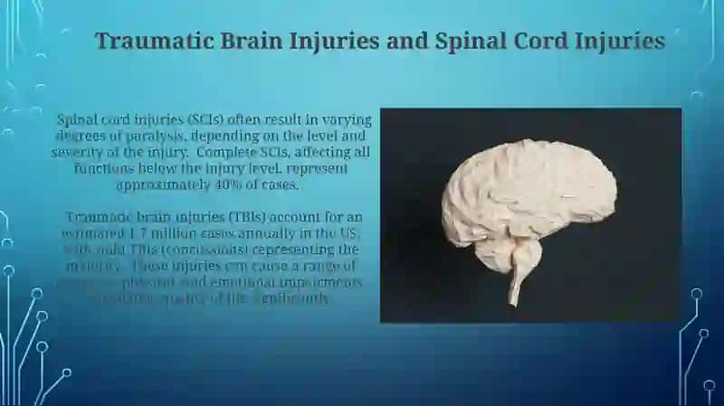 Neuroligiya 4
