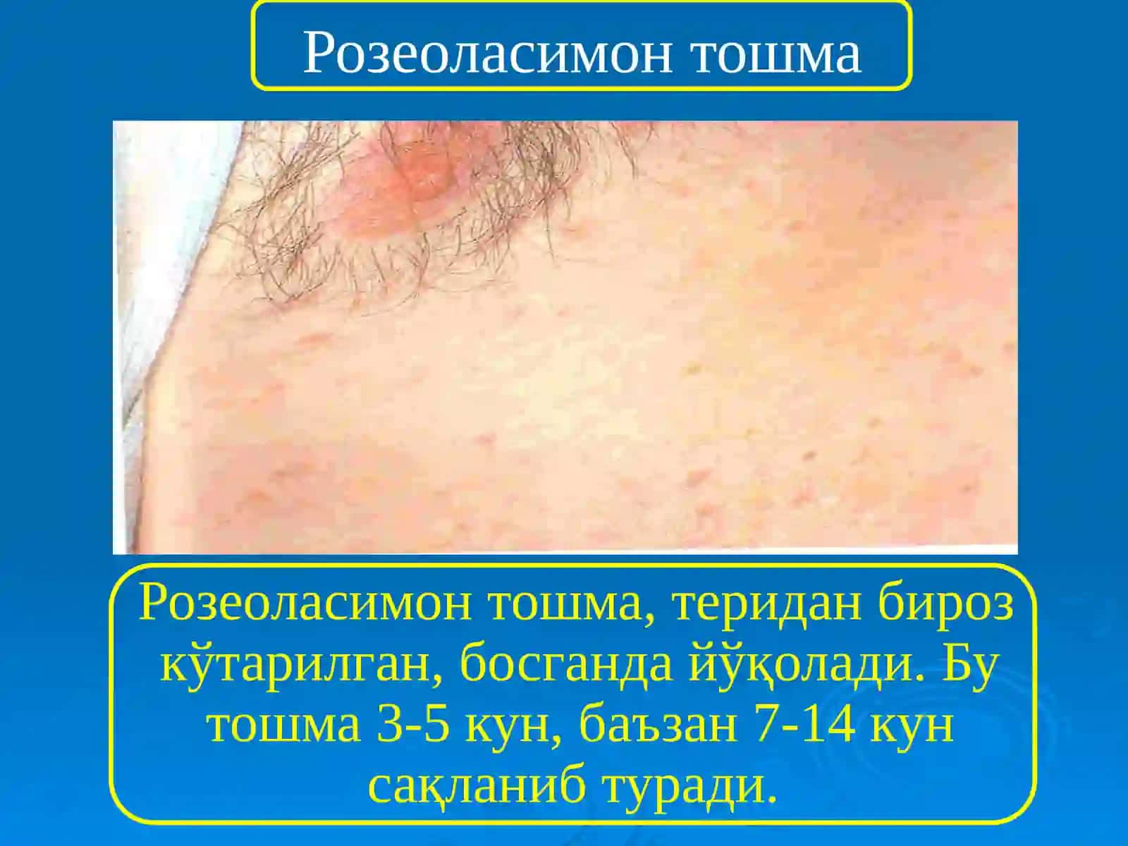 ТИФ-ПАРАТИФ 4