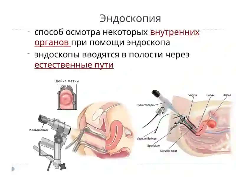 Малоинвазивная хирургия 4