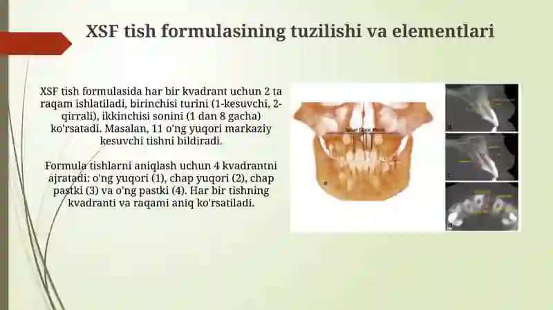 Sutdoimiy tishlar klinik anatomik formulasi 4