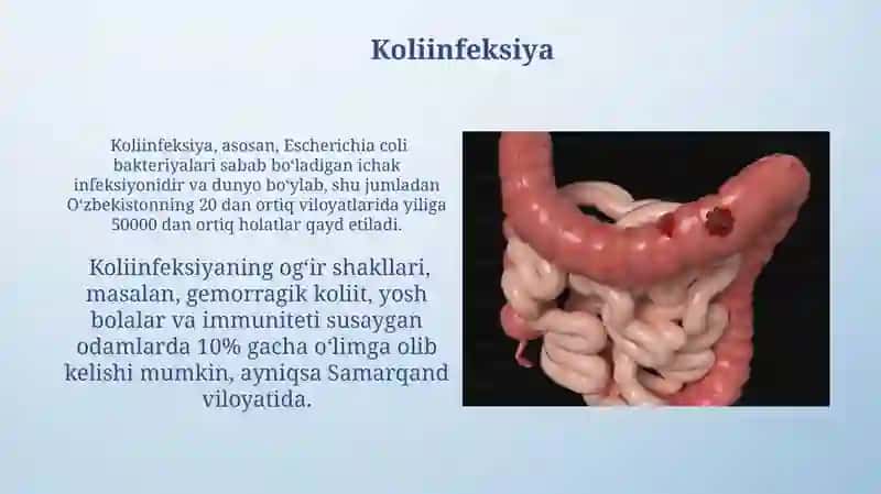 Ichak bakteriyali infeksiyalari va og'iz bo'shlig'idagi o'zgarishlar 4
