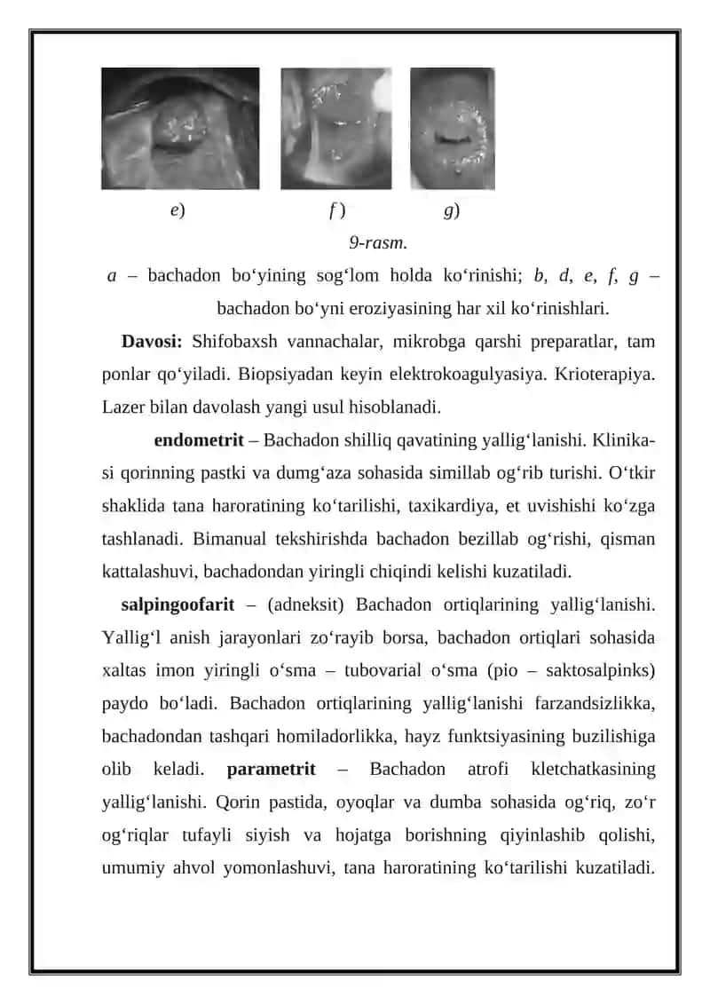 Vulvitni davolash usullari 4