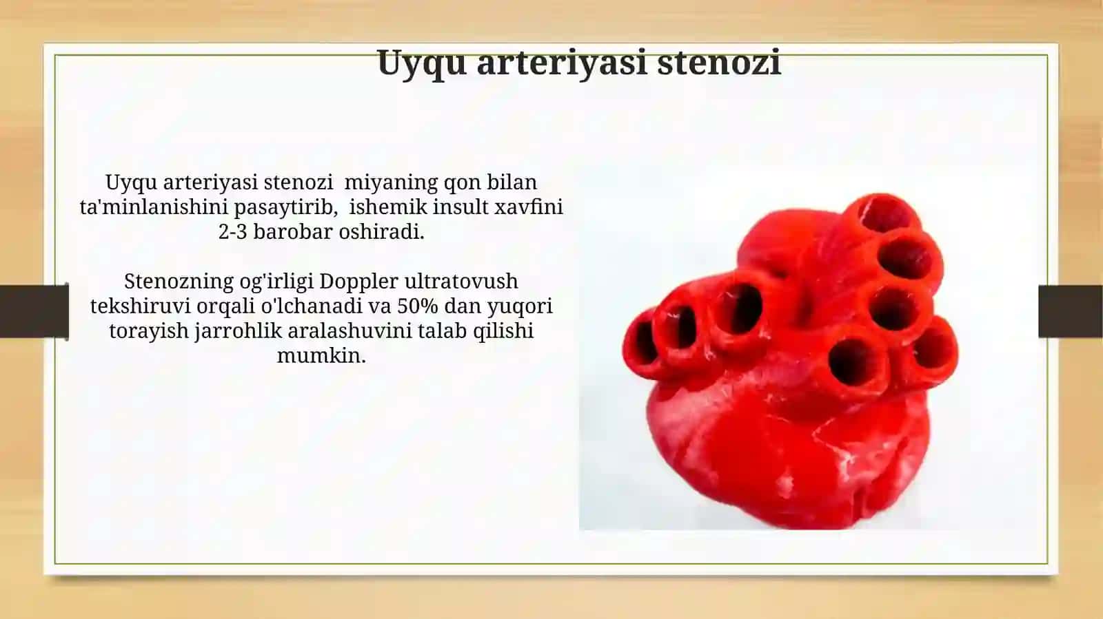 Aorta,aorta ravogi,umumiy va tashqi uyqu arteriyasi 4