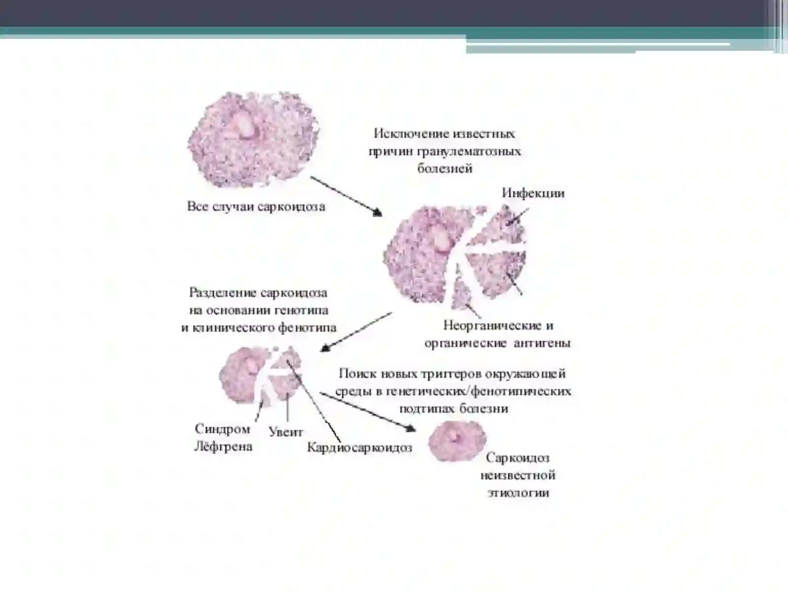 Саркоидоз легких (болезнь Бенье-Бека-Шауманна) 4