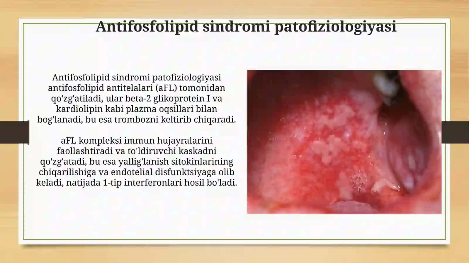 Antifosfolipid sindromi 4
