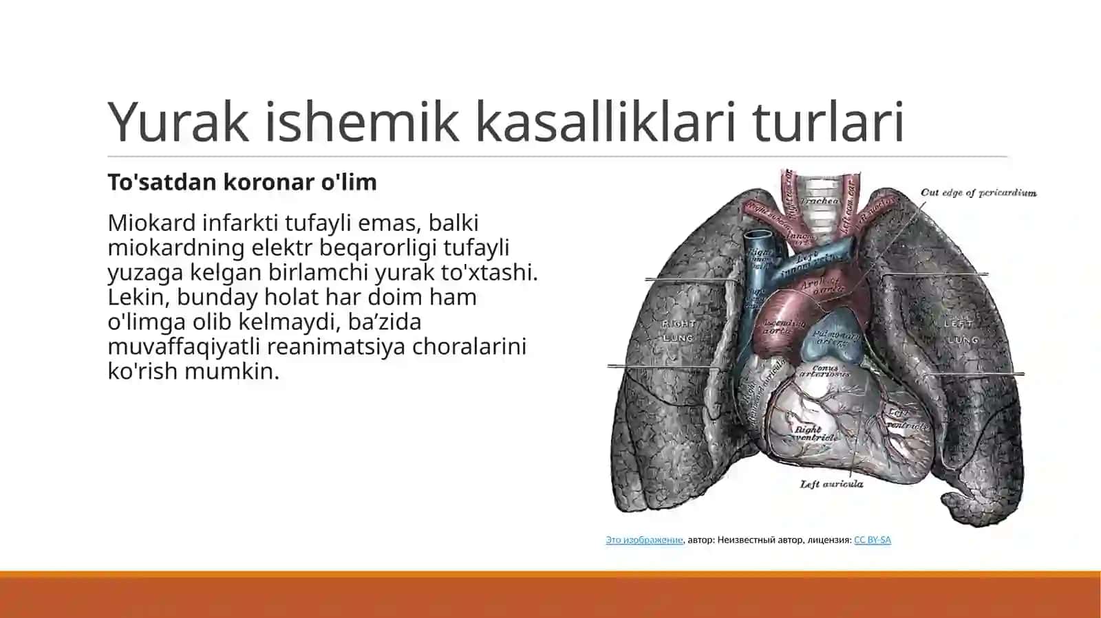 Yurak ishemik kasalliklari 4