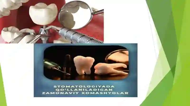 Stomotologiyada texnologiyalarning qo’llanilishi 4
