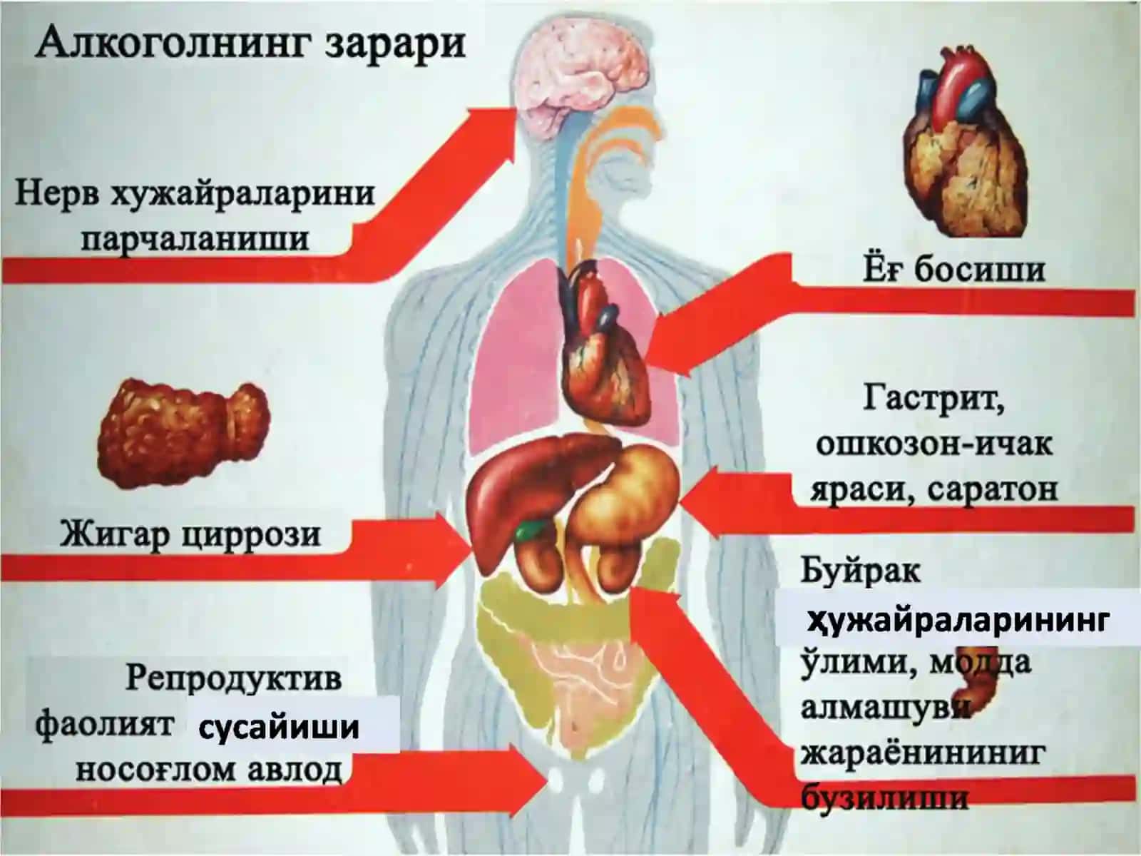 Спиртли ичимликнинг зарари 4