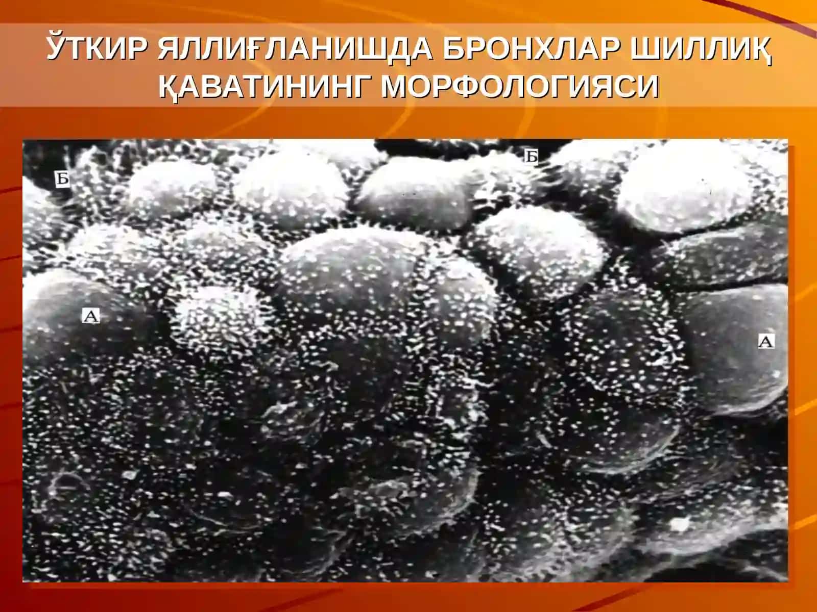БОЛАЛАРДА НАФАС АЪЗОЛАРИНИНГ АФХ.ЎТКИР ЗОТИЛЖАМ 4