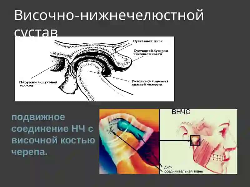 Ортопедическая стоматология 4