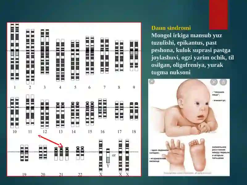 SAMARKAND DAVLAT TIBBIYOT INSTITUTI. PATOLOGIK ANATOMIYA KURSI 4