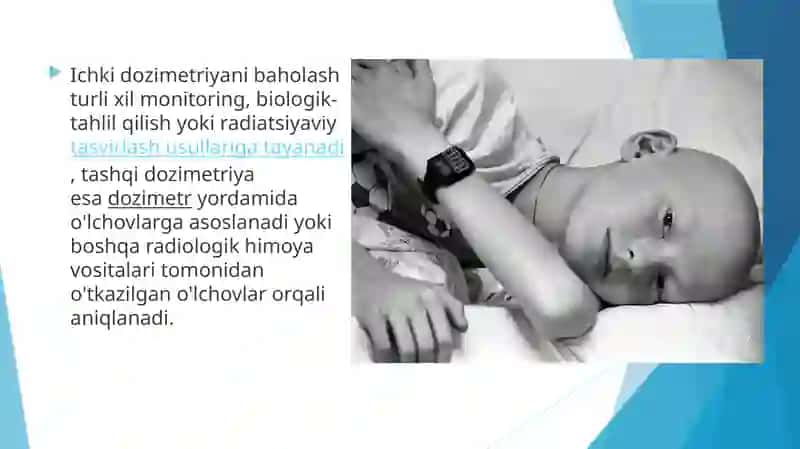 Yutilgannurlarenergiyasindozimetrikbaxolash 4