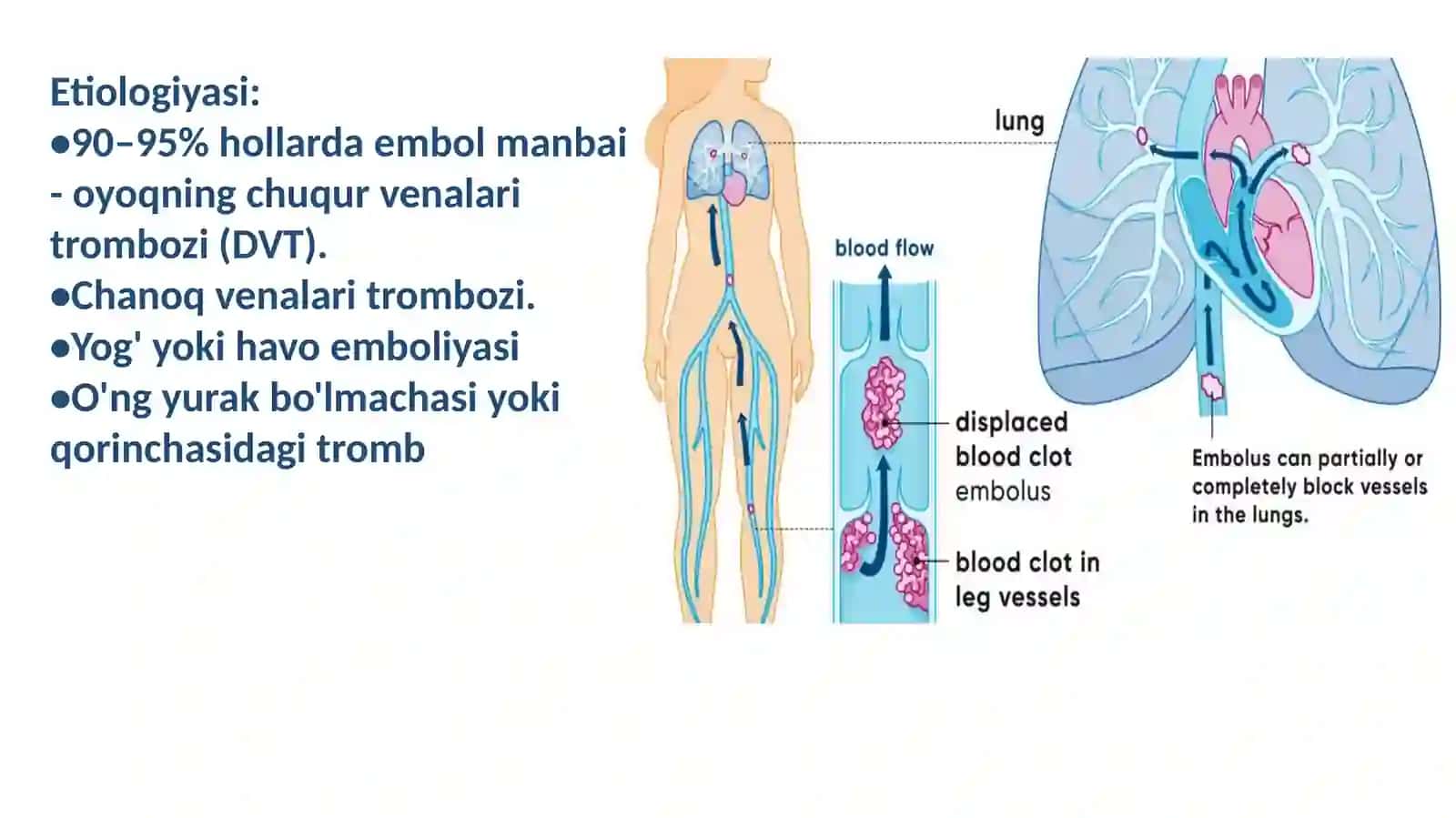 O'pka Tromboemboliyasi 4