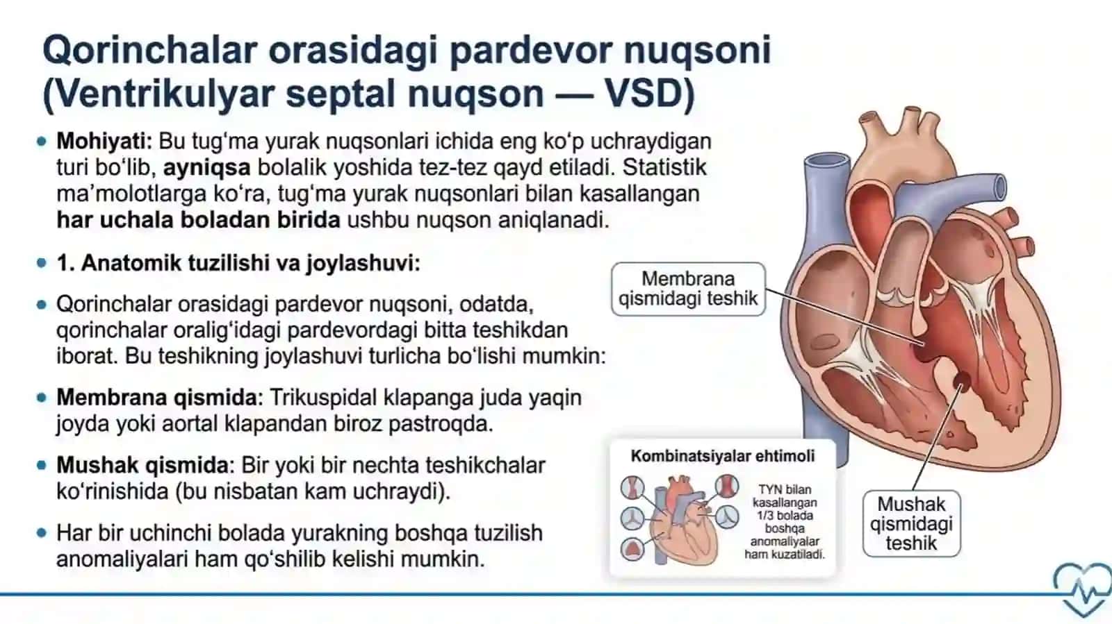 yurak tug'ma nuqsonlari, fallo tetradasi, MTT 4