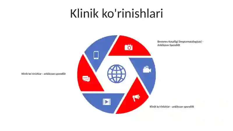 Bexterev Kasalligi Simptomatologiyasi 4