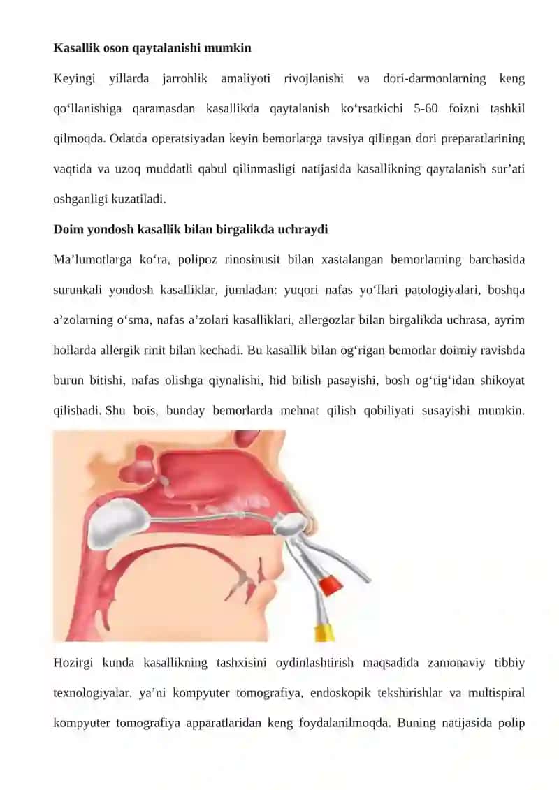 Bolalarda burun qonashi sindromi 4