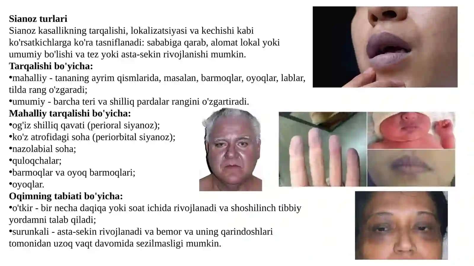 Sianoz bo'yicha differensial diagnostika 4
