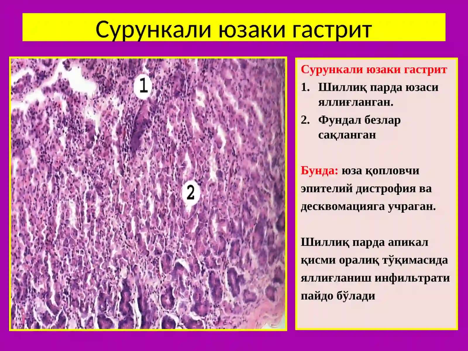 МЕЪДА ФУНДАЛ БЕЗЛАР ТУЗИЛИШИ ВА ТАРКИБИ 4