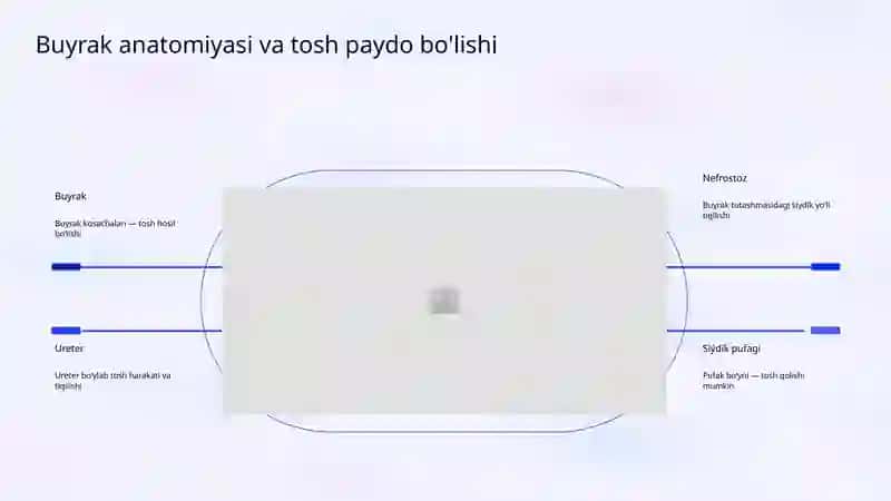 Buyrak kolikasi: Shoshilinch yordam algoritmi 4