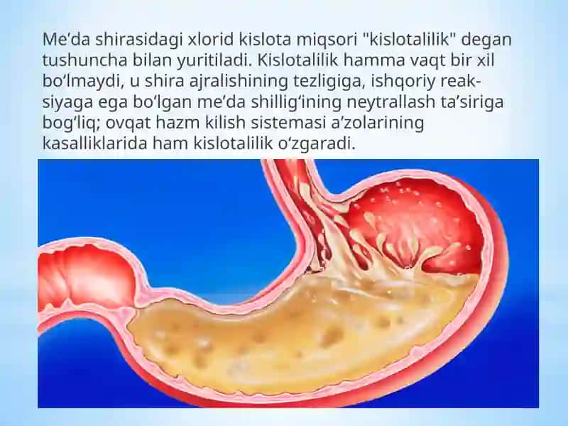 Oshqozon suyuqliği tashxisining klinikahamiyati 4