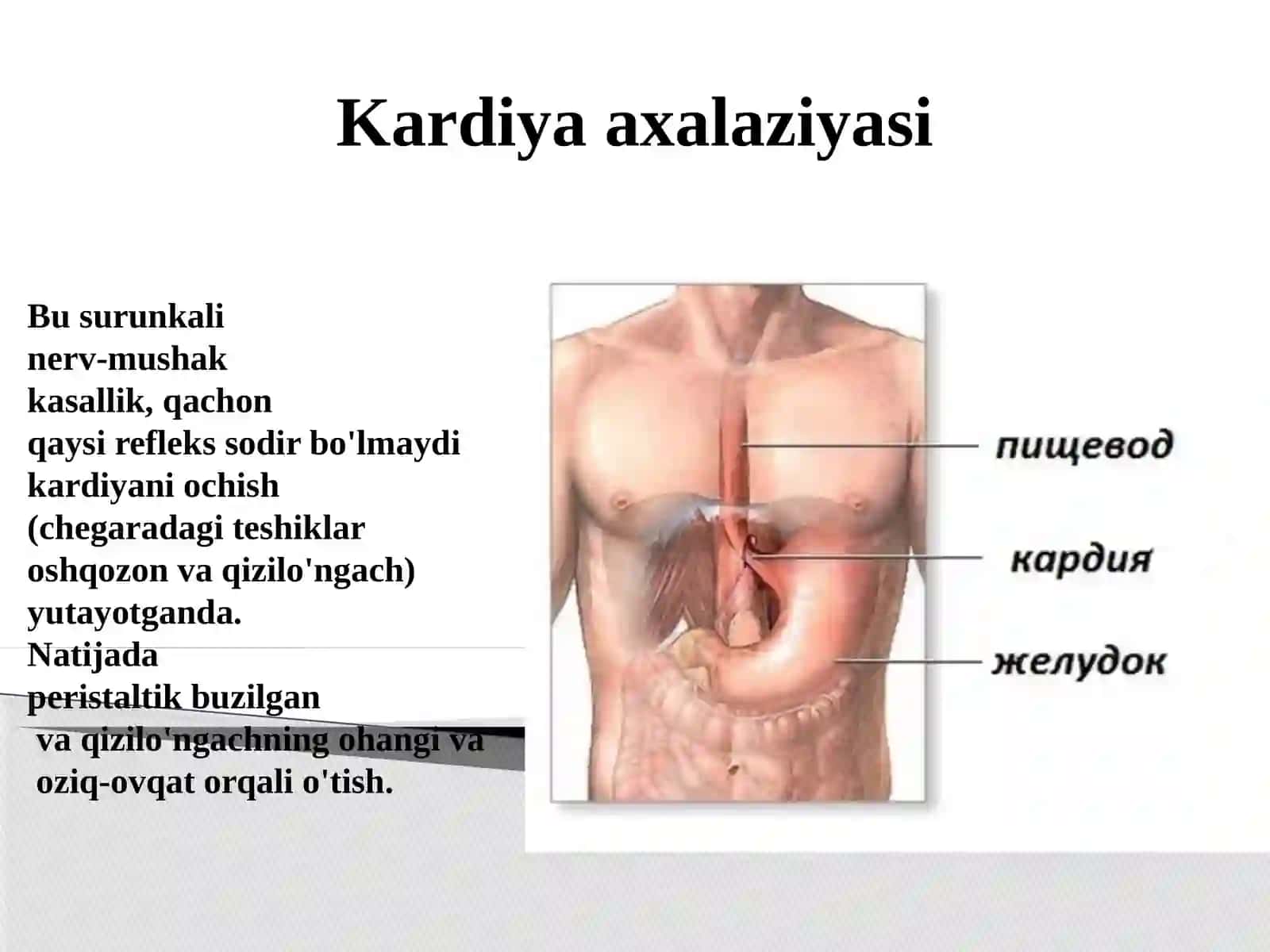 Xazm qilish kasaliklari 4