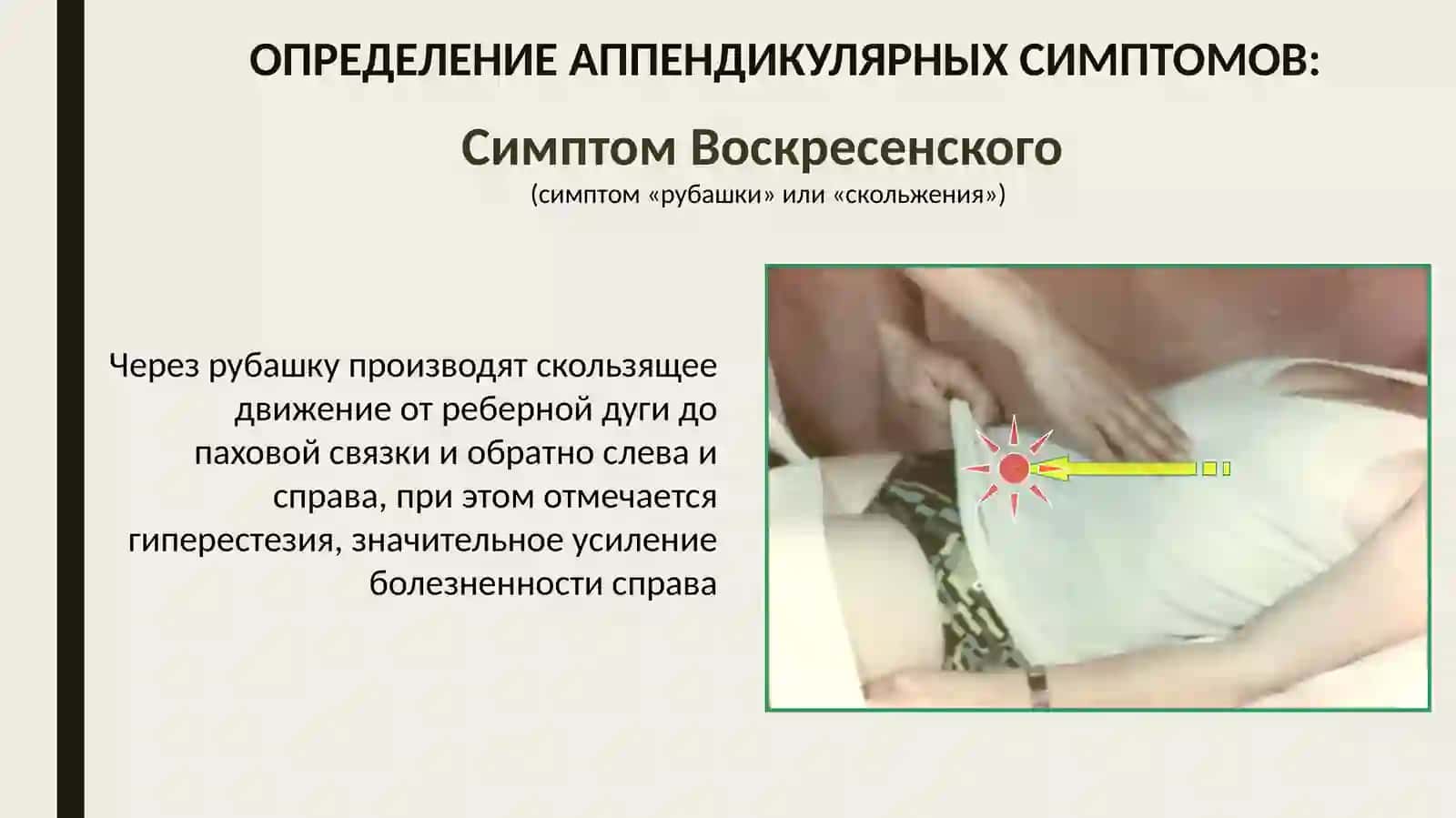 Ректальное исследование при тазовом аппендиците 4