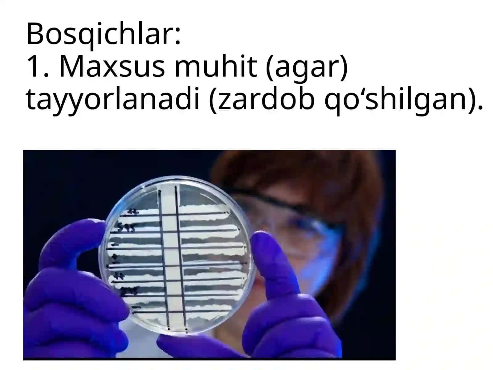 Bug‘ma kasalligida presipitasiya reaksiyasini qoʻyish va natijasini baholash 4