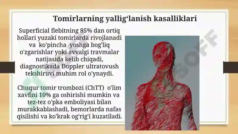 Vena va limfa tomirlari patologiyasi.Tomirlarga aralashishdagi patologiya(intervensii) 4
