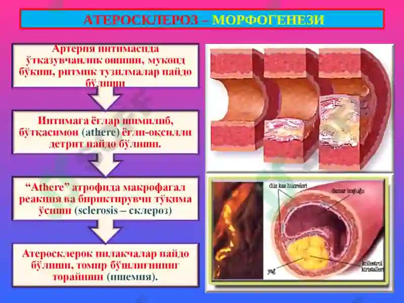 ПАТОЛОГИК АНАТОМИЯ 4