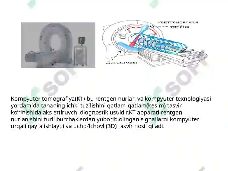 Kompyuter tomografiyasi 4